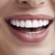 How to Care for Your Replacement Implants Like Natural Teeth