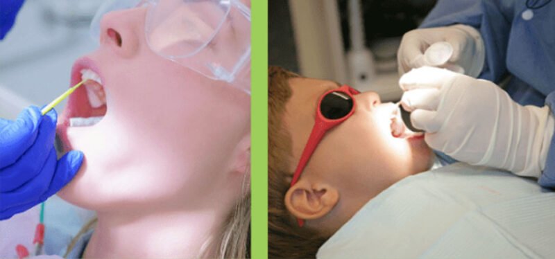 The Benefits of Using Fluoride Varnish Cups in Your Practice